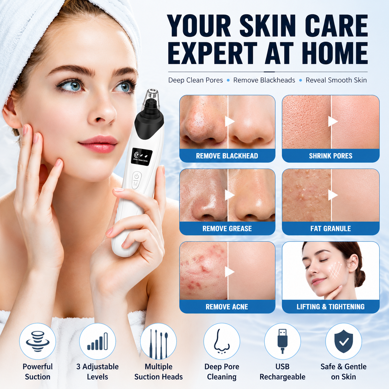Blackhead Remover Vacuum Kit – Deep Pore Cleansing Made Easy