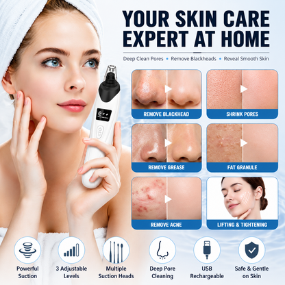 Blackhead Remover Vacuum Kit – Deep Pore Cleansing Made Easy