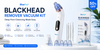 Blackhead Remover Vacuum Kit – Deep Pore Cleansing Made Easy